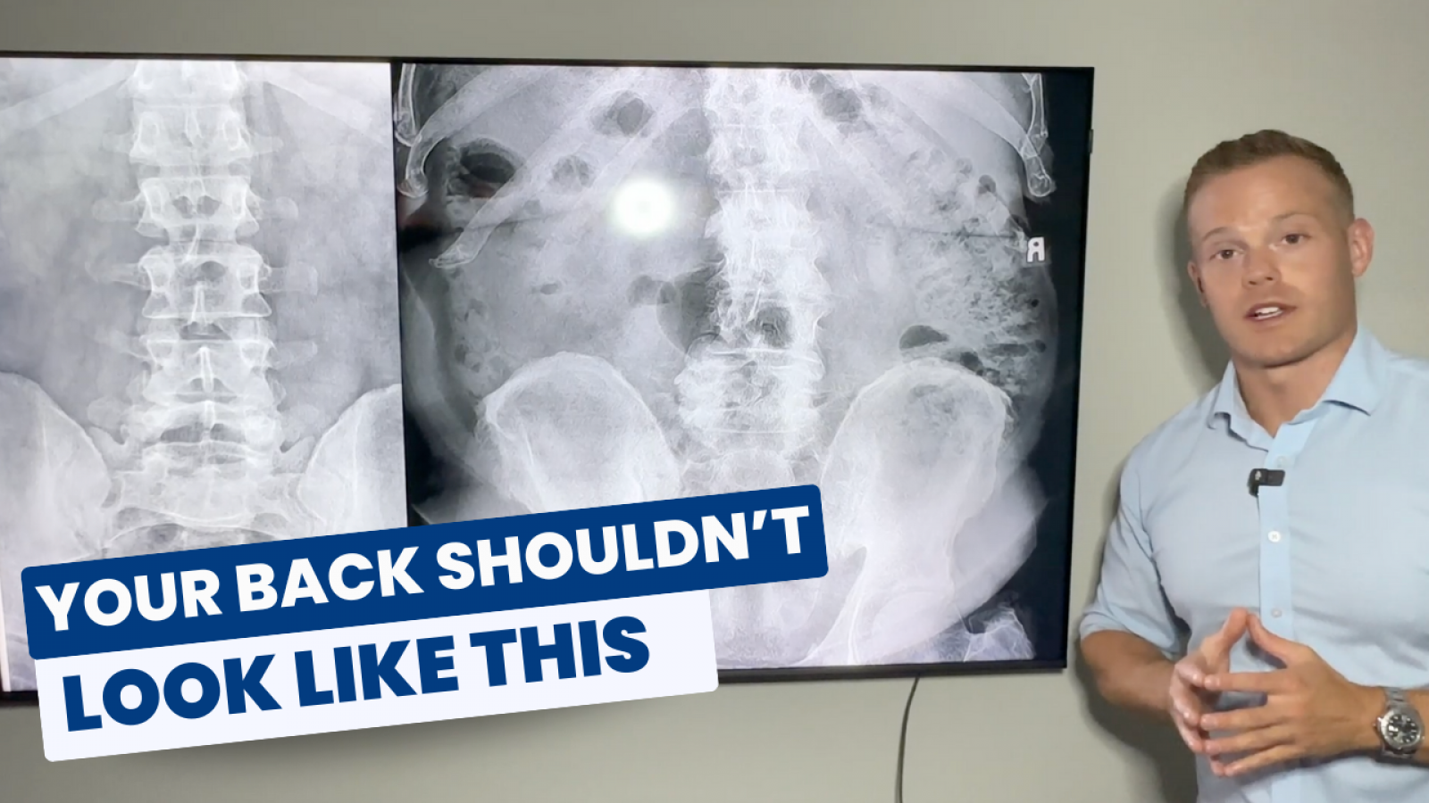 crystal YT thumbs (17)